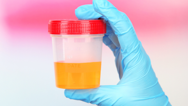 urine infection